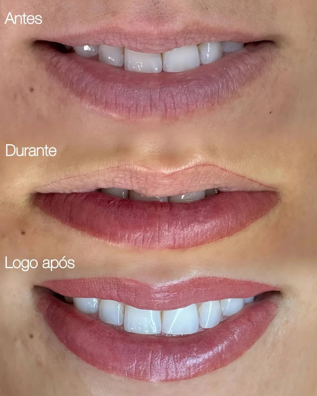 Micropigmentação Labial — miniatura 6
