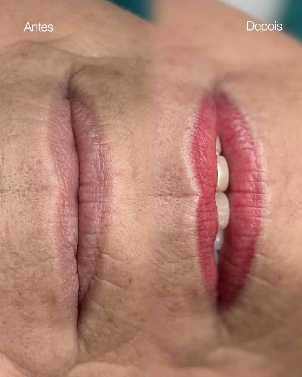 Micropigmentação Labial — miniatura 3